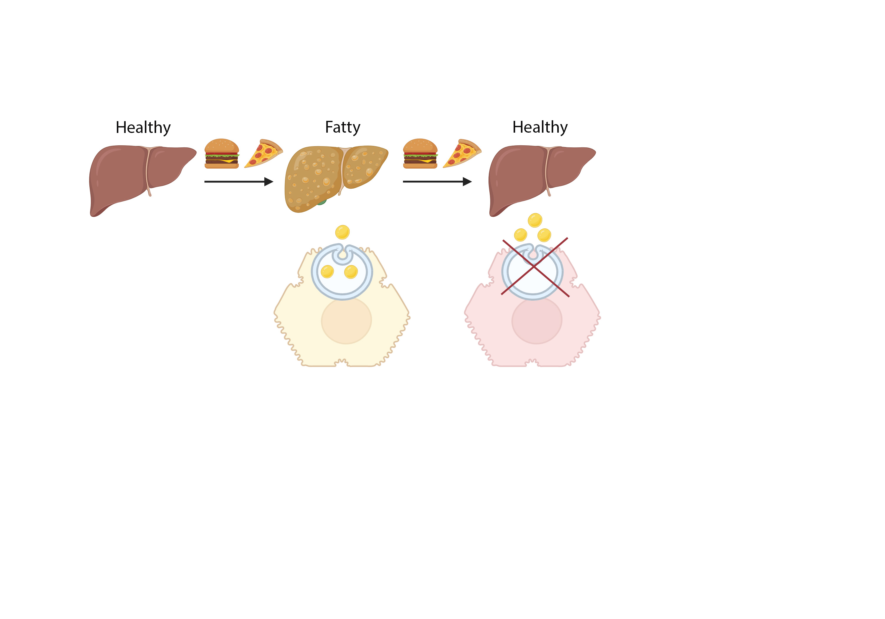 Role of non-canonical autophagy in the liver response to unhealthy ...