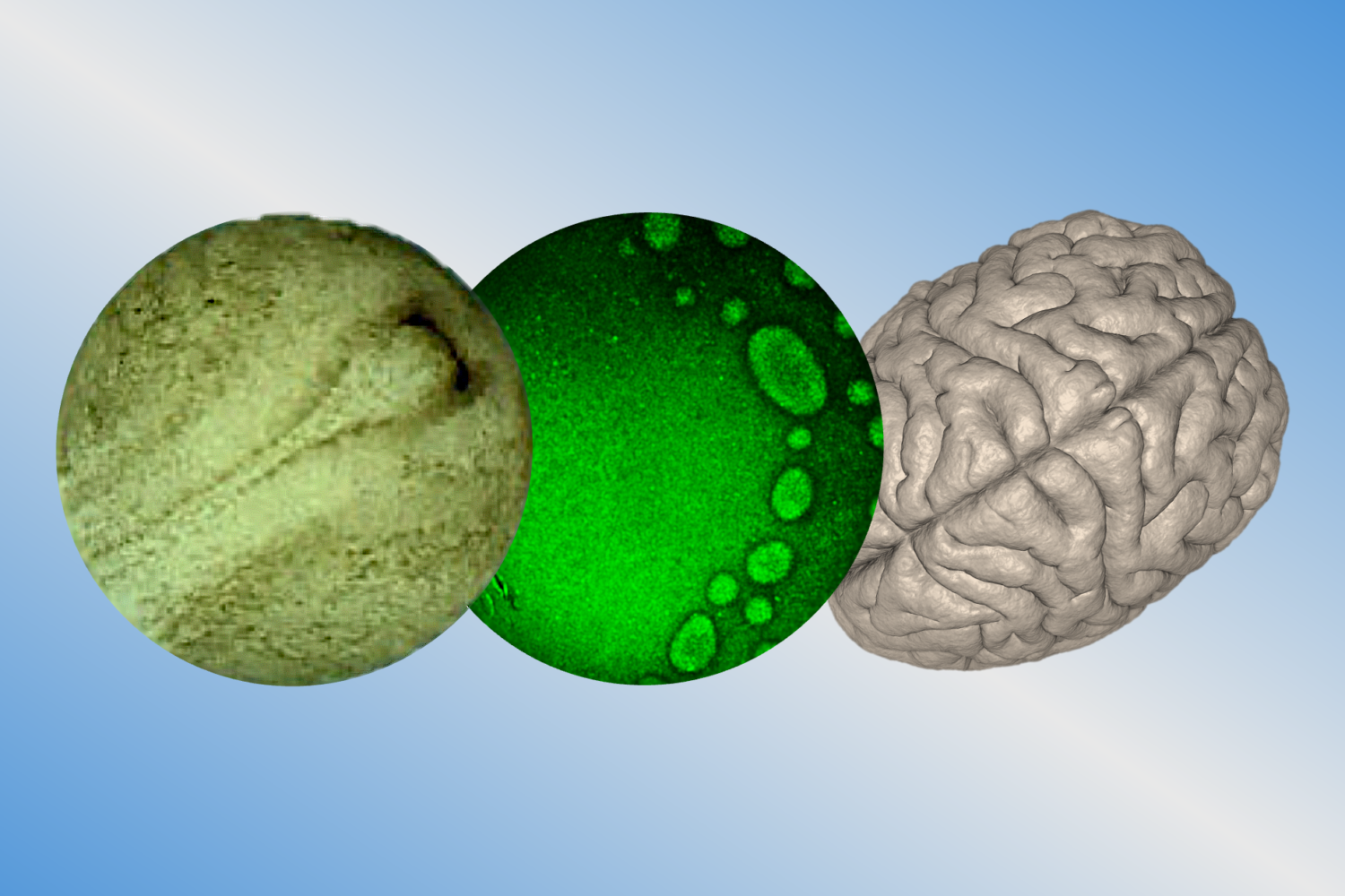 Brain Waves: Modelling human neural induction with pluripotent stem ...